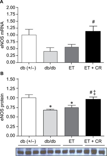 Figure 4 The effects of diabetes, ET, and CR on cardiac eNOS mRNA expression (A) and protein expression (B).