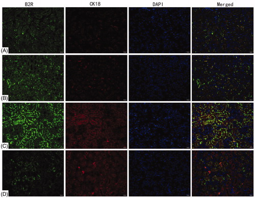 Figure 4. Deposition of B2R on renal tubules. B1R detected by double immunofluorescence staining with CK18. (A) Blank control, (B) vehicle control, (C) 72 h TCE+, and (D) 72 h TCE− group. Magnification =400×. Representative photos are shown.