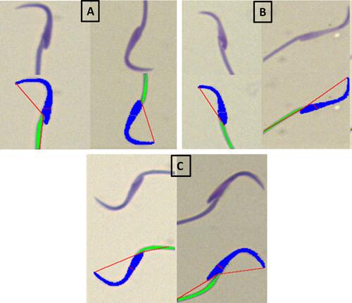 Figure 3 Examples of normal and abnormal rat spermatozoa stained with SpermBlue®. (A) Normal sperm, (B) abnormal (with head defects) and (C) abnormal spermatozoa with midpiece defects.