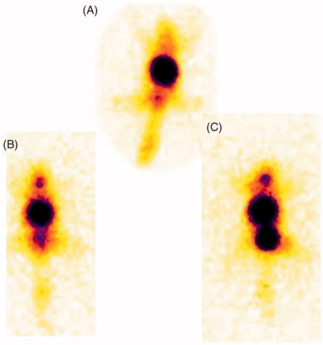 Figure 4. Gamma scintigraphy images of mice (A) MTX after 120 min, (B) MTX-LYS, after 60 min, (C) MTX-LYS after 120 min.
