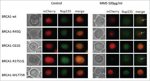 Figure 2. Localization of BRCA1wt and missense variants in the strain RS112 of Saccharomyces cerevisiae after exposure with MMS. Yeast cells co-expressing BRCA1-mCherry fusion proteins and Nup133 were exposed to 100µg/ml MMS for 17 hours. Thereafter, cells were spotted onto glass slides and analyzed under the fluorescence microscope as described in the Materials and Methods. Merged images indicate that BRCA1 wt and all variants localized in the nucleus. In nontreated cells (control) BRCA1wt and all the missense variants localized mainly as “diffuse signal.” Some single nuclear focus was visible also in untreated cells expressing BRCA1 wt or missense variants; these single focused cells were not shown in the image because the number of cells with diffuse signal was more relevant; after MMS treatment, BRCA1wt and the neutral R1751Q localized as single nuclear focus (arrows).