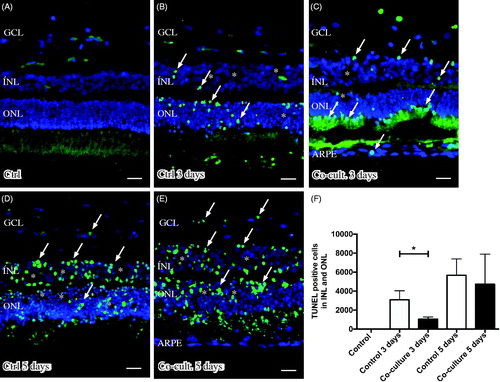 Figure 3. Immunofluorescent images and analysis of cell death by TUNEL assay (green); the cell nuclei are counterstained with DAPI (blue) in non-cultured control retinas (A) and retinas cultured or co-cultured for 3 (B, C) or 5 days in vitro (D, E). Cell death in the outer nuclear layer (ONL) and in the inner nuclear layer (INL) increased over time in the cultured (indicated by arrows in B and D) and co-cultured (indicated by arrows in C and E) retinas when compared to the non-cultured control retinas (A). After 3 days of co-culture with ARPE cells (C, F), cell death was decreased in the retinal specimens when compared to the control retinas (B, F) after 3 days of culture. Cultured retinas retained normal layering post-culture (B–E), shown by separate nuclear layers in the DAPI-stained sections: the outer nuclear layer (ONL), inner nuclear layer (INL), and inner ganglion cell layer (GCL). After culture, the specimens showed holes and injuries, indicated by (*) in the retinal tissue. Occasionally, some TUNEL-labeled ARPE cells were found in the co-culture setup (arrow in ARPE layer in C). Data are expressed as means ± SEM; *P < 0.05; n = 4; scale bars, 20 μM.