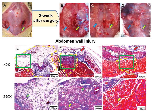 Figure 2. (a) Gross view of the abdominal wounds setting up in the rat; (b) gross view and (e) Masson’s trichrome staining of the abdominal wounds after 2weeks without any film dressing covering (abdominal wound group); (c) gross view and (f) Masson’s trichrome staining of the abdominal wounds after 2-week repairing with DAM dressing (DAM group); (d) gross view and (f) Masson’s trichrome staining of the abdominal wounds after 2-week repairing with DAM-POC dressing (DAM-POC group). Abdominal wounds were indicated by arrows in A–D and in yellow dotted lines in E–G. Lower magnification (top) and higher magnification (bottom) of area in green rectangle were indicated in E–G. DAM and DAM-POC were indicated by red arrows in F and G. In E–G, inflammatory cell was indicated by the green arrow and the newborn myoﬁber was indicated by the yellow arrow