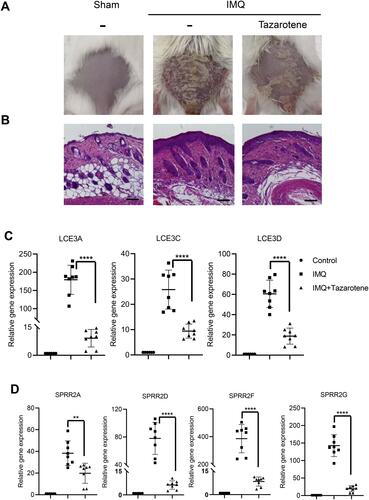 Figure 6 Expression of SPRR and LCE genes were significantly up-regulated in a model of psoriasiform dermatitis. (A) Photograph of mice back skin was taken on day 7. (B) H&E staining of back skin sections were examined on day 7. Scale bar represents 50 μm. (C and D) SPRR and LCE gene expression levels in the skin lesions were evaluated by RT-qPCR. The results are presented as the means ± standard deviation. All experiments were performed 3 times, and the representative results are presented. **P<0.01 and ****P<0.0001.