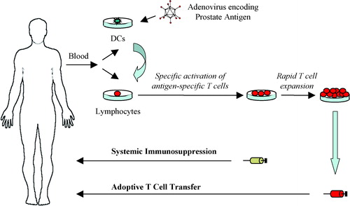 Figure 3. Adoptive transfer of prostate antigen-specific T cells. Monocyte-derived dendritic cells (DCs) are genetically modified with a prostate antigen-encoding adenovirus vector. The modified DCs are mixed with autologous lymphocytes for stimulation of antigen-specific T cells ex vivo. Antigen-specific T cells are selected and rapidly expanded to large numbers for adoptive therapy. The patient receives systemic immunosuppressive chemotherapy prior to the adoptive transfer of T cells.