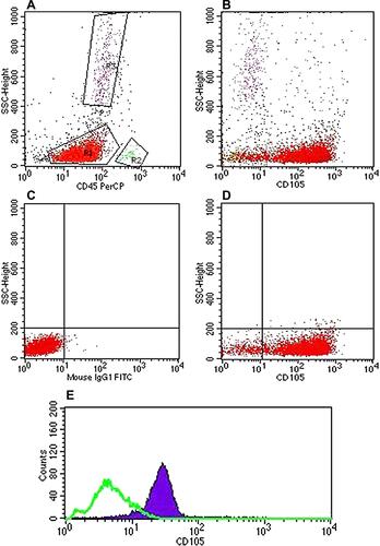 Figure 1 Flow cytometry analysis of CD105 positive case. (A) Dot plot showed gating using CD45/SSC strategy, blast cells (R1), normal lymphocytes (R2) and granulocytes (R3). (B) Scatter dot plot showing blast cells positive for CD105 expression in combination with normal lymphocytes and granulocytes negative for CD105 expression. (C) Dot plot showing the mouse IgG1 isotypic negative control. (D) Dot plot showing positive CD105 expression on gated blast cells. (E) Histogram showing positive CD105 (solid violet curve) versus negative control (green colored curve).
