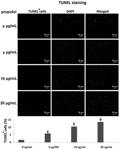 Figure 1. The effects of propofol on apoptosis of hESC-derived neurons. TUNEL assay revealed the percentages of TUNEL+ cells in the hESC-derived neurons treated with 4, 10 and 20 μg/mL propofol for 6 h. Scale bars, 50 mm. Statistically significant differences (ap < 0.05, bp < 0.01).