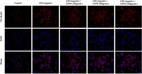 Figure 7. Effects of GPFE on translocation of NF-κB p65 from the cytoplasm to nucleus in LPS-induced RAW264.7 cells by using confocal microscope.