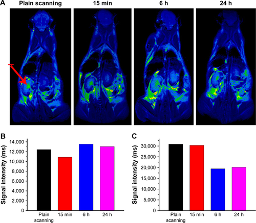 Figure S7 (A) T2-weighted in vivo magnetic resonance imaging (MRI) images of mice post-injection of the Fe3O4@mSiO2/PDDA/BSA-Gd2O3 nanocomplex at different time points (0, 15 min, 6 h, and 24 h). The signal intensities in the kidneys (B) and bladder (C) at different time points after intravenous injection of the Fe3O4@mSiO2/PDDA/BSA-Gd2O3 nanocomplex. The red arrow indicates the kidney.