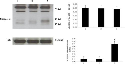 Figure 4. Targeting STAT3 increases cleaved caspase-3 levels in Bel-7402 Cells.