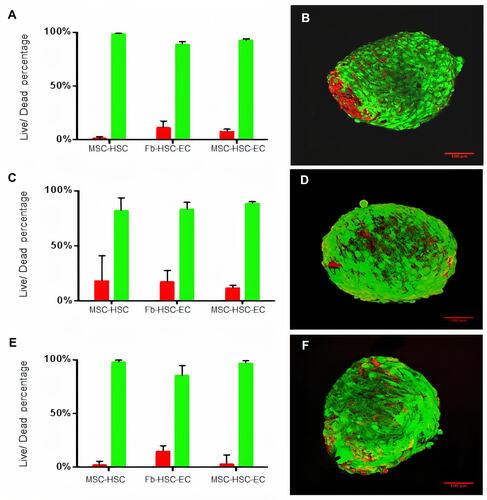 Figure 3 Viability of 3D cultures. (A and B) Cell viability in 1% O2, (C and D) Cell viability in 3% O2, (E and F) Cell viability 21% O2. (B, D, F) LIVE/DEAD® viability kit. Red: dead cells, Green: live cells. Olympus confocal microscope FV1000, 20× (scale bar: 100μm).