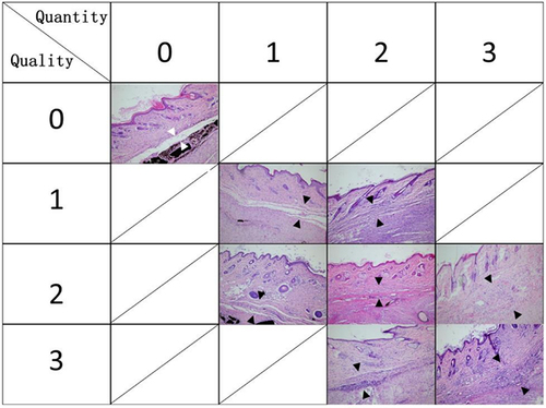 Figure 1 Adhesion formation was scored based on the grading criteria proposed by Tang et al (H&E; 100 ×).Citation32 Quantitative scores: 0, no adhesion; 1, a few scattered filaments; 2, a large number of filaments; 3, countless filaments. Qualitative scores: 0, no adhesion; 1, regular elongated fine filaments; 2, irregular mixed shortened filaments; 3, dense scar. The adhesion scores = quantitative score + qualitative score. The white arrowheads indicate no adhesion between the tendon surface and subcutaneous tissue; the black arrowheads represent different adhesion formation degrees.