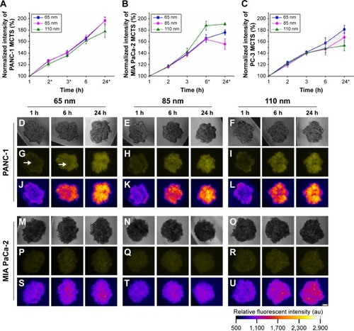 Figure 2 Uptake of different sizes of nanoparticles (65 nm, 85 nm, and 110 nm) in the MCTS of the PANC-1, MIA PaCa-2, or PC-3 cell lines.Notes: (A) Normalized relative fluorescence intensity of the MCTS of the PANC-1 cell line at different time intervals. (B) Normalized relative fluorescence intensity of the MCTS of the MIA PaCa-2 cell line at different time intervals. (C) Normalized relative fluorescence intensity of the MCTS of the PC-3 cell line at different time intervals. For the MCTS of the PANC-1 cell line treated with 65 nm, 85 nm, and 110 nm nanoparticles at 1 hour, 6 hours, and 24 hours: (D–F) bright field images, (G–I) fluorescence images with the white arrow highlighting the uneven distribution of the nanoparticles, and (J–L) intensity maps showing the relative fluorescent intensity of different regions of the MCTS of PANC-1. For the MCTS of the MIA PaCa-2 cell line treated with 65 nm, 85 nm, and 110 nm nanoparticles at 1 hour, 6 hours, and 24 hours: (M–O) bright field images, (P–R) fluorescence images, and (S–U) intensity maps showing the relative fluorescent intensity of different regions of the MCTS of MIA PaCa-2. The scale bar represents 100 μm. Error bars indicate the standard deviation and the number of samples used in each measurement (n=4). *Indicates statistical difference (P<0.05) amongst the three mean fluorescent measurements at that time point, obtained from the testing of the three nanoparticle solutions based on the single variable analysis of variance test.Abbreviations: MCTS, multicellular tumor spheroids; PLGA, poly lactic-co-glycolic acid; DSPE, distearoyl-sn-glycero-3-phosphoethanolamine-N; h, hours.