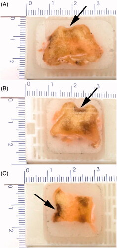 Figure 5. Histological observation of Beagle femoral trochleae after 12 weeks postimplantation. (A) Chondrocyte/osteoblast-loaded β-TCP bioceramic scaffold group. (B) Chondrocyte-loaded β-TCP bioceramic scaffold group. (C) β-TCP bioceramic scaffold. Arrows indicate the cartilage defects where the scaffolds were implanted.