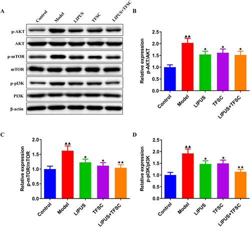 Figure 8. LIPUS combined with TFSC inhibits PI3K/AKT/mTOR pathway in ovarian granulosa cells. (A–D) The protein expression levels of p-PI3K/PI3K, p-AKT/AKT, p-mTOR/mTOR in ovarian granulosa cells were detect by Western blot, n = 3, compared with control group, ▲p < .05, ▲▲p < .01; compared with model group, ★p < .05, ★p < .01.