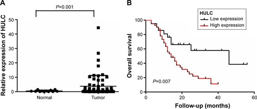 Figure 1 Relative expression of HULC in glioma tissues and its relationship with overall survival of glioma patients.