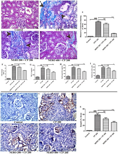 Figure 9. The upper panel (A-D) shows the effect of nerolidol 200 and 400 mg/kg, p.o against cyclophosphamide-induced renal fibrosis (MT staining, 400 × magnification), whereas figure E represents the semi-quantitative analysis of MT staining. Figure (F-I) represents the effect of nerolidol 200 and 400 mg/kg, p.o against cyclophosphamide-induced markers of renal fibrosis such as TNF-α, IL-6, IL-1β, and IL-10, estimated in the in vivo study. Lower panel (A-D) represents the effect of nerolidol 200 and 400 mg/kg, p.o against cyclophosphamide-induced Smad3 expression in the renal tissue (400 × magnification). figure E represents the semi-quantitative analysis of Smad3 level in renal tissue. One-way ANOVA, i.e., tukey’s multiple comparison test was used for statistical analysis.