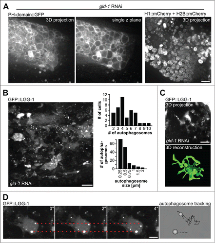 Figure 2. Characterization of tumor cells and autophagosomes. (A) Tumor cells as visualized by their plasma membranes (left, PH domain of PLCd1 fused to GFP) or their nuclei (histone-mCherry fusion proteins). Scale bar: 10 μm. (B) Left: Autophagosomes in tumor cells as visualized by GFP::LGG-1, a representative maximum projection of a central tumor area is shown, scale bar: 10 μm. Top right: Quantification of numbers of autophagosomes per cell. Bottom right: Quantification of autophagosome size. Quantifications were performed by manual counting/measurements. (C) 3D reconstruction of cell shapes of those cells in the germline tumor expressing GFP::LGG-1. Top: Original microscopy 3D projection data, scale bar: 5 μm; bottom: 3D reconstruction performed in imod (see Methods). (D) Movement of autophagosomes inside tumor cells. Left: Stills from time-lapse recordings, the dashed lines mark the initial position of an autophagosome, scale bar: 5 μm. Right: Magnified data from autophagosome tracking using Endrov (see Methods). Autophagosome paths are shown as black lines. Note that the movement of the bottom autophagosome is due to the sample shifting (see Movie S1). All panels in Fig. 2 show animals at the d 3 of adulthood.