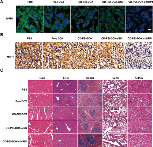 Figure 8 The effect of different drugs on MRP1 expression and tissue integrity on mouse models.