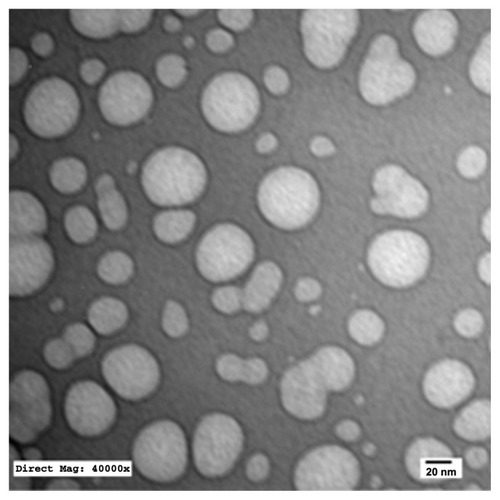 Figure 8 Transmission electron microscopy photograph of placebo nanocarriers with 1000-fold dilution in distilled water (×40,000).