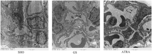 Figure 2. Electron microscopic evaluation of changes in glomerular. The GS group showed that basement membrane thickness varies, foot process diffuse fusion, disappear. The ATRA group presents fewer lesions than the GS group. Magnification 30000×.