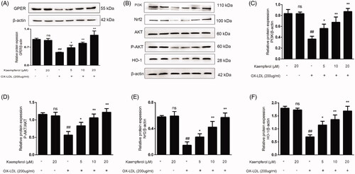 Figure 9. Kaempferol activated the GPER and regulated the PI3K/AKT/Nrf2 Pathway. HAECs cells were treated with kaempferol or free-foetal medium. Then, the cells were treated with indicated drugs or complete medium. The expression of GPER (A), PI3K (C), P-AKT/AKT (D), Nrf2 (E) and HO-1 (F) was detected by Western blot assay. Data are analysed by one-way ANOVA and unpaired t-test and presented as the mean ± SD. ##p < 0.01 vs. the control group. *p < 0.05 and **p < 0.01 vs. the ox-LDL group. ns: not significant (p > 0.05 vs. the control group) (n = 5).