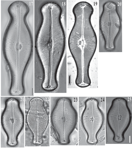 Figs 17–25. LM images of Didymosphenia geminata cells in valve view showing size variation. Fig. 17: Courtesy of S. Spaulding, Figs 18–24: Courtesy of D. Metzeltin. Reprinted from Metzeltin & Lange-Bertalot (Citation2014, Iconographia Diatomologica 25) with the permission of Koeltz Scientific Books. Fig. 25: D. hullii cell in valve view. Scale bars = 10 μm.