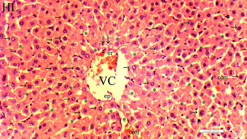 Figure 2 Representative light microscopy of hepatic tissue from the dexmedetomidine group.