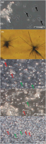 Figure 2. Mantle cells. (a) Explant of mantle from the Manila clam after 4 days in culture showing migration of explant cells (white arrow), and fibroblast-like (black arrow). (b) Formazan crystals formed with mantle cells after 3 weeks in culture. These crystals formed after incubation 72 h with MTT. (c) Example of dissociated mantle cells after 4 days in culture; oval-shaped cells (red arrow), and suspended cells (green arrow). (d) Cells from mantle explant after 2 weeks in culture; (e) after 4 weeks in culture. Clusters of cells suggesting proliferation (white arrow), oval-shaped cells (red arrow), and suspended cells (green arrow)