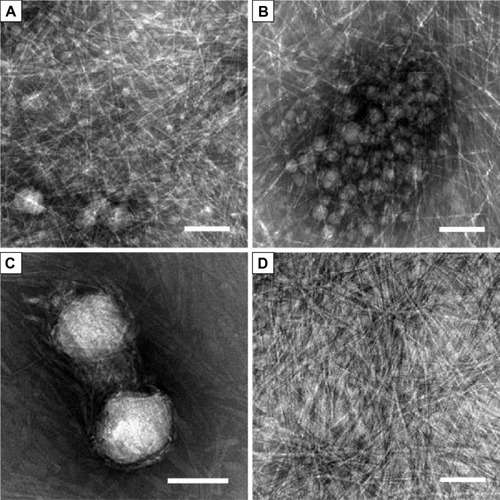 Figure 3 Transmission electron microscopic images of nanostructures in the suspension and supernatant.Notes: (A–C) Nanostructures in the suspension. (A, B) were from the same sample, showing A6K nanofibers as well as nanoparticles with a diameter of tens of nanometers. (C) Larger pyrene particles with a diameter of about 100 nm were observed in another transmission electron microscopy sample. (D) Only A6K nanofibers were present in the supernatant. Scale bar, 100 nm.