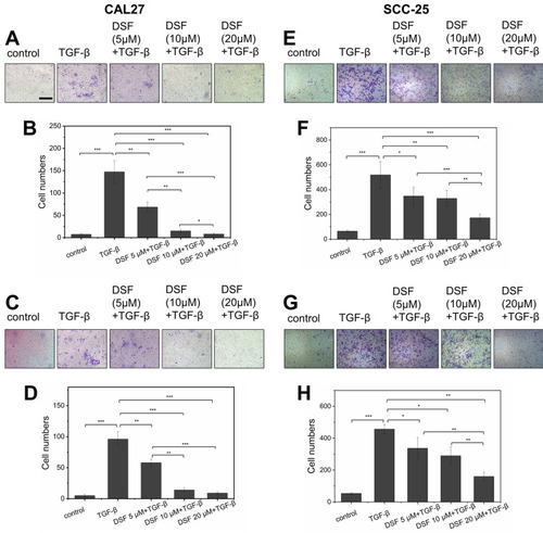 Figure 2 Dsf suppressed TGFβ1-induced migration and invasion in OSCC cells.