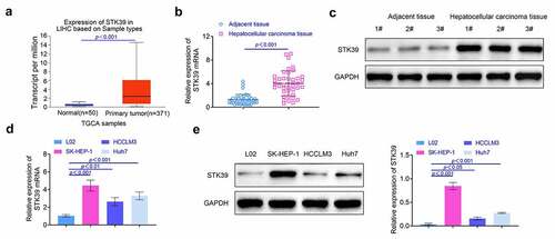 Figure 1. The expression of STK39 was promoted in HCC tissues. (a) The expression of STK39 in HCC tissues was explored with the database. (b) The expression of STK39 in HCC tissues was determined with the RT-PCR, n = 40. (c) The levels of STK39 in HCC tissues was detected with the western blotting. (d, e) The expression of STK39 in HCC cells was detected with the RT-PCR and western blotting, respectively. Each experiment repeated for at least three times. **p < 0.01, ***p < 0.001 vs. L02 cells