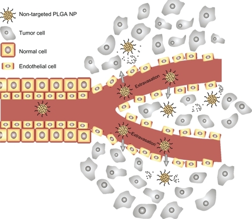 Figure 4 Enhanced permeability and retention effect. Passive tissue targeting is achieved by extravasation of nanoparticles through increased permeability of the tumor vasculature and ineffective lymphatic drainage.Abbreviations: PLGA, polylactide-co-glycolide; NP, nanoparticles.