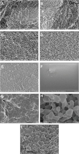 Figure 2 SEM images of all calcium phosphate samples of interest to the present study.Notes: All images are at a magnification of 7,000× (5 μm scale bar). (A) Cancellous bone, (B) cortical bone, (C) porous nano-HA, (D) porous nano-TCP, (E) porous biphasic nano-TCP/HA, (F) dense sintered nano-HA, (G) porous silica-substituted micron-HA, (H) porous micron-TCP, and (I) porous biphasic micron-TCP/HA. The crystal structure of dense nano-crystalline HA cannot be seen at this low magnification.Abbreviations: SEM, scanning electron microscopy; HA, hydroxyapatite; TCP, tri-calcium phosphates.