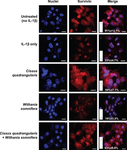 Figure 5 Immunofluorescence analysis of survivin in chondrocytes.