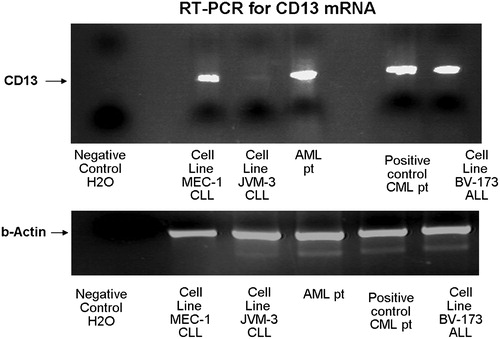 Figure 3. RT-PCR for APN/CD13 mRNA in cell lines. The RT-PCR showed positive results for APN/CD13 mRNA in the MEC-1 and BV-173 cell lines and negative in the JVM-3 cell line. Samples from patients with a CD13(+) acute myeloid leukaemia (AML) and a chronic myeloid leukaemia, respectively, were used as positive controls.