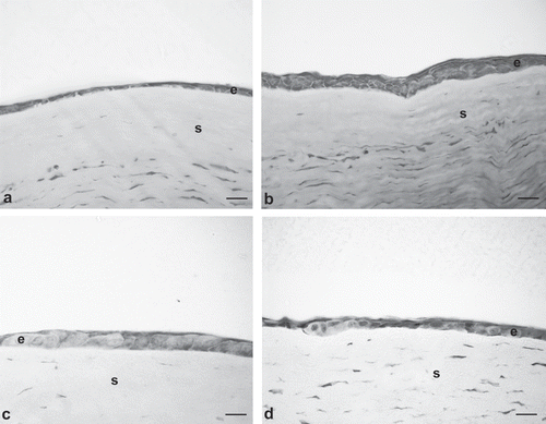 FIGURE 3  Photomicrographs of damaged corneas, recovered spontaneously [(A) control, thickness 6 μm], or treated with: AG-Sol [(B) thickness 18 μm]; TSP [(C) thickness 18 μm]; and HA-Sol [(D) thickness 12 μm]; corneas were excised immediately before complete recovery of the corneal lesion. Scale bar = 20 μm. Legend: e = epithelium; s = stroma.