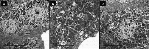 Figure 11. Electron micrographs of sections for proximal convoluted tubules of adult male rats in all study groups. a Control group, proximal tubular cells rest on thin regular basement membrane (BM). The tubular cells have regular euchromatic nuclei (n) with prominent nucleoli (n) and regularly packed apical microvilli (mv), the basal parts of the cells show basal infoldings (i) with regularly arranged mitochondria (m). b DN group, the proximal tubular cells rest on thick basement membrane (BM). They have heterochromatic nuclei (N), rarified cytoplasm (*) with some vacuolated areas (v) and disorganized apical microvilli (mv). The basal parts of the cells show disorganized basal enfolding with disorganized mitochondria (M). c DN + ZnO-NPs group, the proximal tubular cell rests on a thin regular basement membrane (BM). It has normal cytoplasm with evident vacuoles (V), a regular euchromatic nucleus (N), lysosomes (l) and regularly packed apical microvilli (mv). The basal part of the cell shows basal infoldings (I) with regularly arranged mitochondria (M).