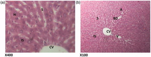 Figure 2. (Normal control) Histologic section through the liver at magnification ×400 (a) and ×100 (b) shows the area of interlobular septum, central vein, portal triad, sinusoidal layer and plates of hepatic cells all within normal limits. Conclusion: Normal liver not affected. H – hepatocytes; S – sinusoidal layer; IS – interlobular septum; CV – cytoplasmic vacuolation; A – normal architecture; BD – bile duct; V – vein.