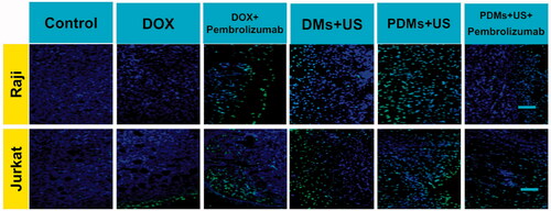 Figure 10. TUNEL staining of Raji and Jurkat lymphomas treated with different formulations. Raji and Jurkat cell-grafted mice were treated with saline, DOX, DOX + pembrolizumab, DMs + US, PDMs + US, and PDMs + US + pembrolizumab for 21 d. Green: apoptotic cell DNA; Blue: cell nuclei. Scale bar: 100 μm.