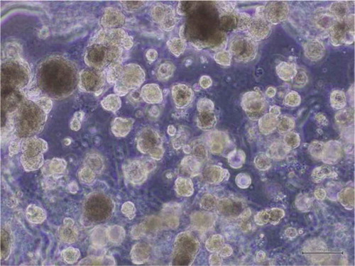 Figure 2. Representative phase contrast microscopy of salivary gland organoid cultures from the human parotid gland.