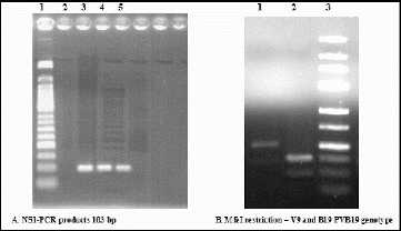 Figure 4. Electrophoresis in 2% and 3% agarose gels. (A) Lane 1: 50 bp molecular marker; Lane 2: negative control; Lanes 3, 4 and 5: samples with a positive result. (B) Lane 1: V9 DNA (no cleavage); Lane 2: HPVB19-DNA (two fragments with a size of 36 and 67 bp); Lane 3: 25 bp molecular marker.