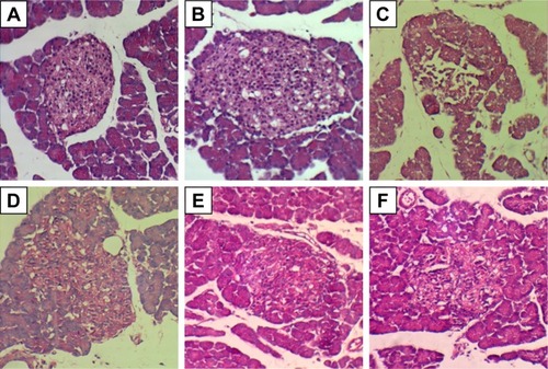 Figure 8 H&E images from pancreatic islet of rats in different groups: normal control group (A), high-fat diet group (B), diabetic control group (C), DIBc low-dose group (D), DIBc medium-dose group (E), and DIBc high-dose group (F).