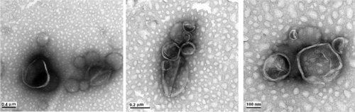Figure 3 NS-TEM images of liposomes.