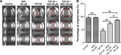 Figure 5 Effects of resveratrol on TGF-β2-induced collagen gel contraction in ARPE-19 cells.
