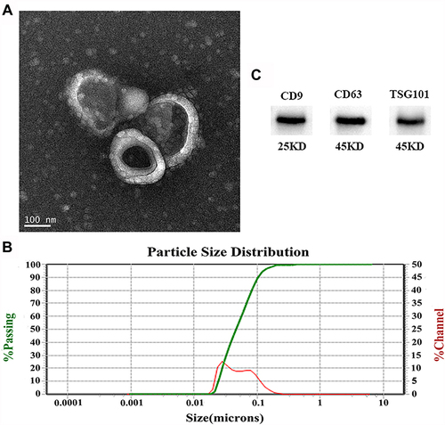 Figure 1 Characteristics of plasma-derived exosomes. (A) Representative exosome image identified by a TEM (scale bar: 100 nm). (B) Nanoparticle tracking analysis (NTA) of exosomes showed they have a diameter of 30–150 nm. (C) Western blotting identified three exosome-specific markers (CD9, CD63, and TSG101).