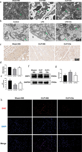 Figure 3. Clemastine attenuates cardiomyocyte mitochondrial damage and dysfunction. (a) TEM showed mitochondrial ultrastructural changes in septic rat hearts, as indicated by green arrows; (b) TEM showed mitochondrial ultrastructural changes in H9c2 cardiomyocytes, as indicated by green arrows (n = 3); (c) Representative myocardial SOD2 immunofluorescence staining images; (d) Relative intensity of myocardial SOD2 expression via immunofluorescence staining; (e) Myocardial ATP levels from respective rat groups; (f) Representative gel blots depicting DRP1 levels in vivo; (g) DRP1/GAPDH levels; (h) DHE staining was performed to detect ROS levels in rat heart sections (400X) (n = 3). *P < 0.05 vs Sham+NS, **P < 0.01 vs Sham+NS, ***P < 0.001 vs Sham+NS, #P < 0.05 vs CLP+NS, ##P < 0.01 vs CLP+NS.