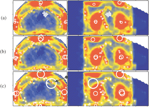 Figure 2. Delineated potential hot spots in fat tissue at a selection level of (a) six, (b) four and (c) three times the OST.