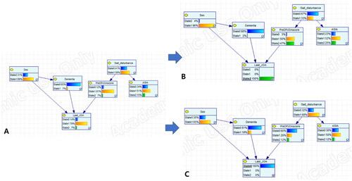 Figure 4. Final Bayesian network structure and different conditions for the LastJOA obtained using GeNIe. Panel A shows the Bayesian structure learned with the existing dataset using GeNIe. State 0 and 1 in the Gait_disturbance, dementia and sex nodes represent the probability of the occurrence of that comorbidity for the first two variables or male. States 0, 1 and 2 in the other nodes represent the discretized values of 0, 1 and 2, respectively. Panels B and C show that the change in the states in other variables after the LastJOA was conditioned as state 0 or 2. ASIA: American Spinal Injury Association; LastJOA: last follow-up Japanese Orthopaedic Association score; PreJOA: preoperative Japanese Orthopaedic Association score.