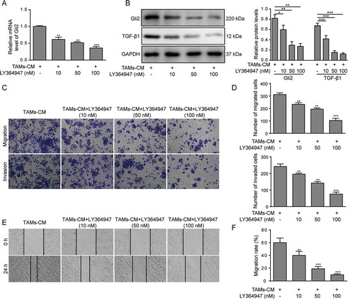 Figure 2. TGF-β1 signaling mediates the effect of TAMs-CM on Gli2 expression and Huh-7 cell migration and invasion